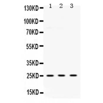UCHL1 / PGP9.5 Antibody (aa120-153)