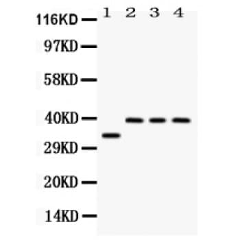 PPP1R1B / DARPP-32 Antibody (aa1-36)