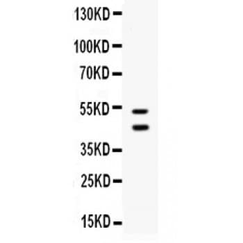 Polyclonal Rabbit anti-Human PROCR / EPCR Antibody (aa18-210, WB)