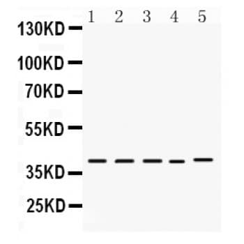 Polyclonal Rabbit anti-Human DMRT1 Antibody (aa98-128, IHC, WB)