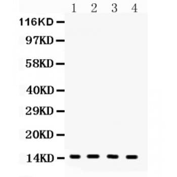 Polyclonal Rabbit anti-Human FABP4 / AP2 Antibody (aa10-40, IHC, WB)