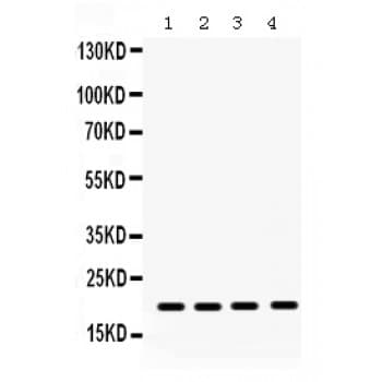 NME1 / NM23 Antibody (aa26-58)