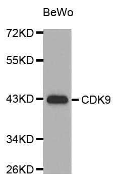 Polyclonal Rabbit anti-Human CDK9 Antibody (IHC, WB)