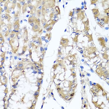 Polyclonal Rabbit anti-Human TNFAIP6 / TSG-6 Antibody (IHC, WB)