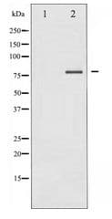 Polyclonal Rabbit anti-Human PRKCD / PKC-Delta Antibody (IHC, WB)