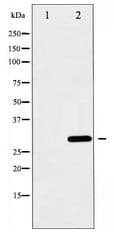 Polyclonal Rabbit anti-Human BCL2L1 / BCL-XL Antibody (IHC, IF, WB)