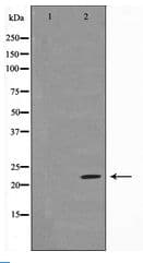 Polyclonal Rabbit anti-Human BAD Antibody (IHC, WB)
