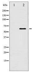 Polyclonal Rabbit anti-Human DOK1 Antibody (IHC, WB)