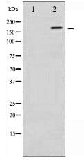 Polyclonal Rabbit anti-Human FANCD2 Antibody (IHC, WB)