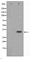 Polyclonal Rabbit anti-Human PPP1R1B / DARPP-32 Antibody (IHC, WB)