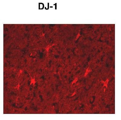 Polyclonal Rabbit anti-Human PARK7 / DJ-1 Antibody (C-Terminus, WB)