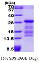 Human Securin / PTTG1 Protein (Recombinant His)