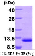Human CCL22 / MDC Protein (Recombinant His)