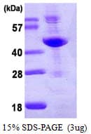 Human ADA / Adenosine Deaminase Protein (Recombinant His)