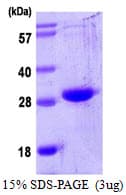 Human OSM / Oncostatin M Protein (Recombinant His)