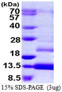 Human TFF1 / pS2 Protein (Recombinant His)