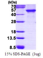 Human SGK1 / SGK Protein (Recombinant His)
