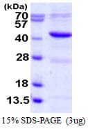 Human MAPK14 / p38 Protein (Recombinant His)