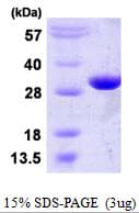 Human PGAM2 Protein (Recombinant His)
