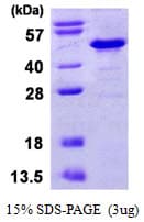 Human NFKBIB / IKB Beta / IKBB Protein (Recombinant His)