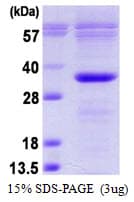 Human BCL10 / BCL-10 Protein (Recombinant His)