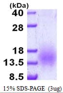 Mycobacterium tuberculosis EsaT-6 Protein (Recombinant His)