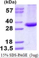 Mycobacterium tuberculosis fbpA Protein (Recombinant His)