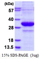 Human KLK3 / PSA Protein (Recombinant His)
