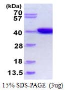 E. coli ldhA Protein (Recombinant His)