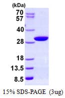 Human PAFAH1B3 Protein (Recombinant His)