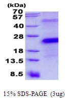 Human CD27 Protein (Recombinant His)