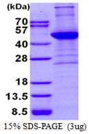 Human ACTA2 / Smooth Muscle Actin Protein (Recombinant His)
