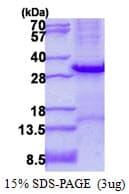 Human TPSAB1 / Mast Cell Tryptase Protein (Recombinant His)