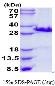 Mouse LGALS3 / Galectin 3 Protein (Recombinant His)