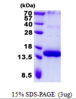 Human TNFRSF17 / BCMA Protein (Recombinant His)