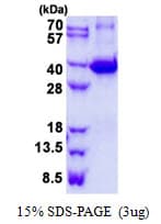 Mouse LGALS9 / Galectin 9 Protein (Recombinant His)