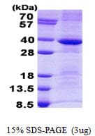 Human CTSS / Cathepsin S Protein (Recombinant His)