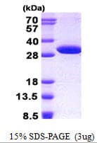 Human NUDT14 Protein (Recombinant His)