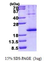 Human TNFRSF13B / TACI Protein (Recombinant His)