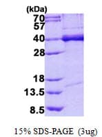 Human TDP-43 / TARDBP Protein (Recombinant His)