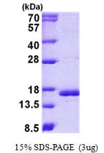 Human CST3 / Cystatin C Protein (Recombinant His)