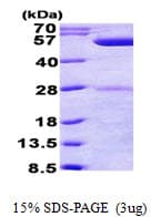 E. coli phr Protein (Recombinant His)