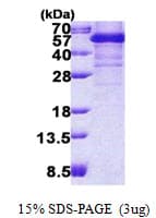 Human TDP-43 / TARDBP Protein (Recombinant His)