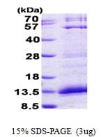 Human CXCL4 / PF4 Protein (Recombinant His)