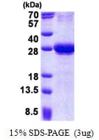 Human CXADR Protein (Recombinant 6His, N-terminus)