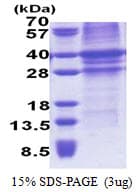 Human TFPI / LACI Protein (Recombinant His)