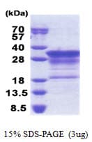 Human MBP / Myelin Basic Protein (Recombinant His)