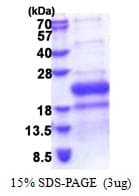 Human TNFRSF14 / CD270 / HVEM Protein (Recombinant His)