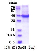 Human RBM11 Protein (Recombinant His)