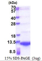 Human NRG4 Protein (Recombinant His)
